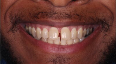 Before - Sale Dental Spa