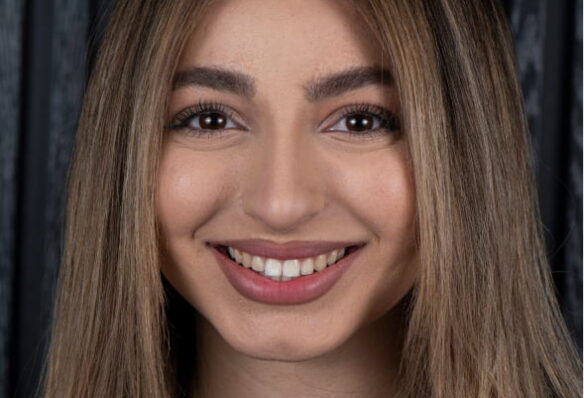 Before - Predent General, Cosmetic & Implant Dentistry